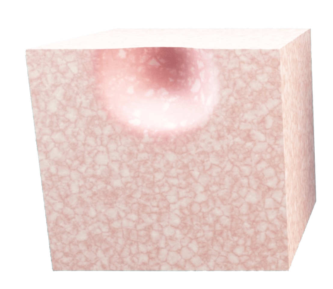 QMR Terapisi Öncesi