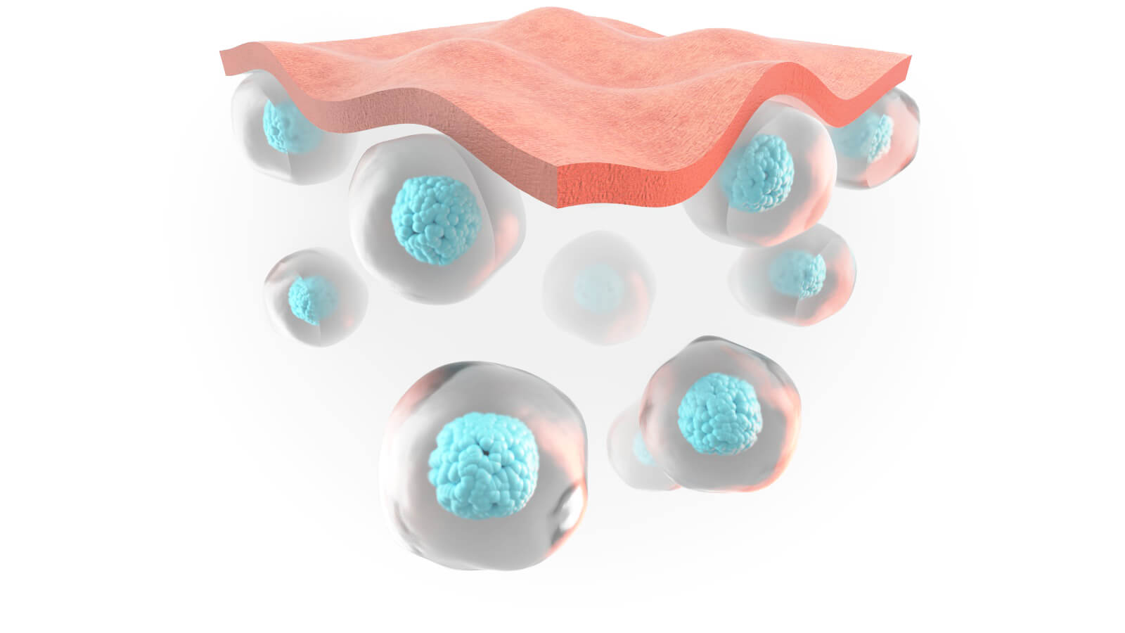 Rexonage3 - Before QMR therapy